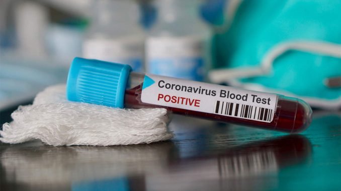 Truck driver tests positive for COVID-19
