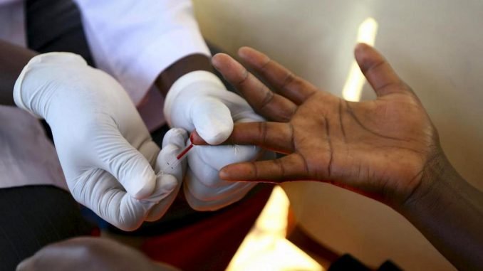 HIV-AIDS testing